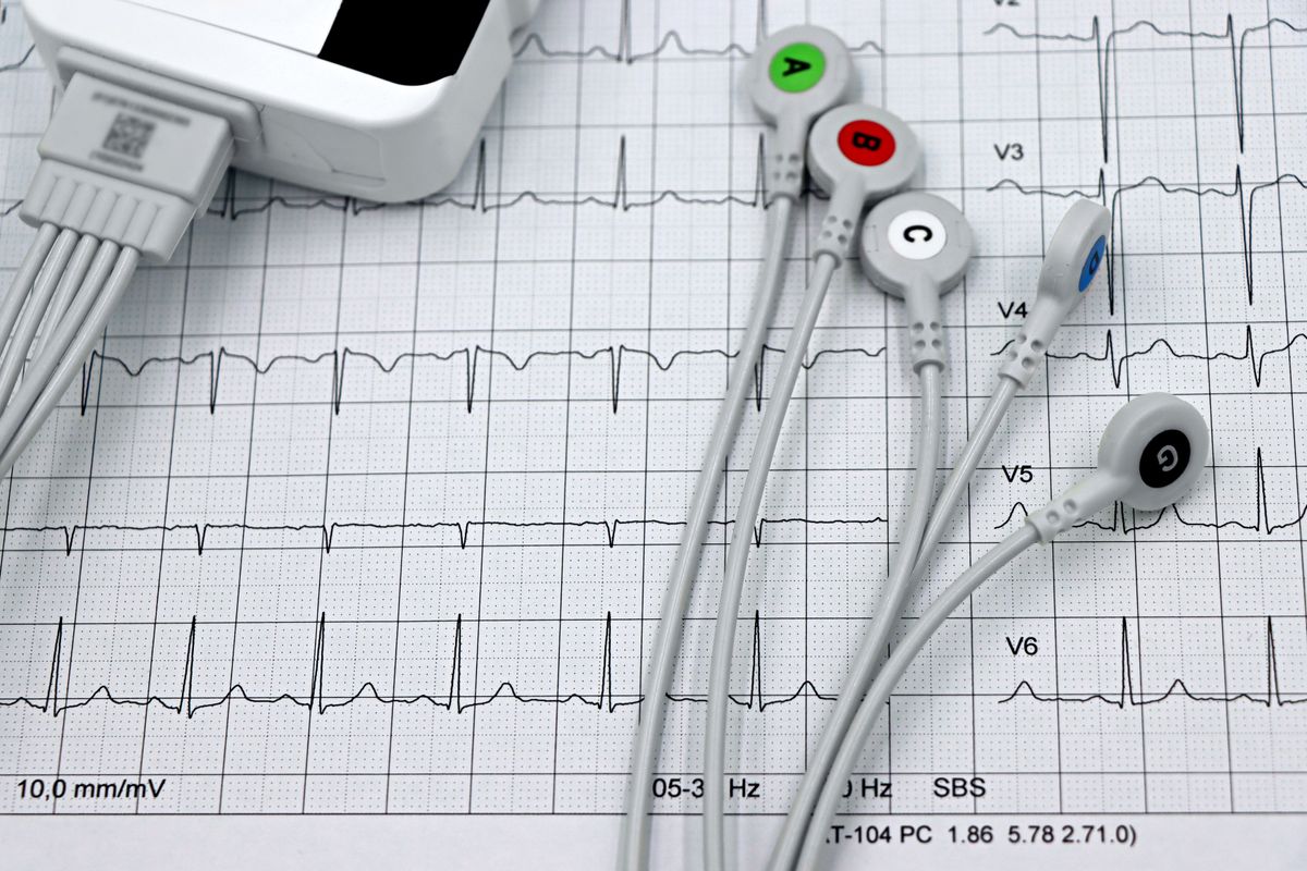 Close-up of a detailed ECG heart-monitor printout