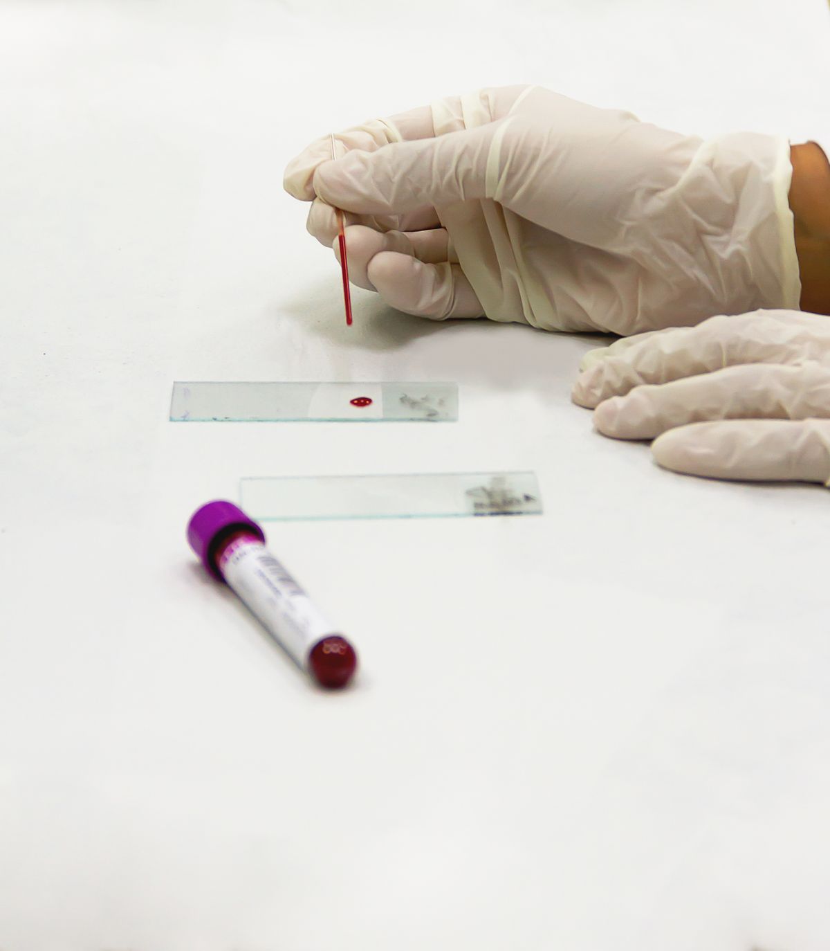 Lab technician performing a blood test