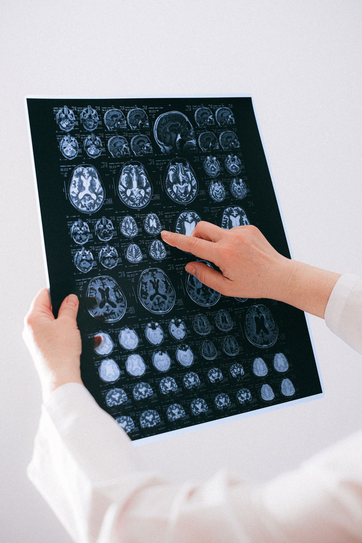 Doctor holding and examining a brain scan film