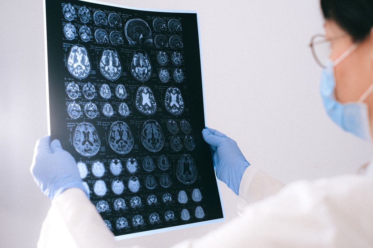 Neurologist studying a brain MRI