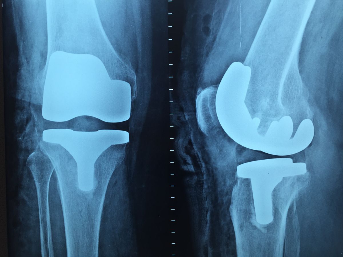 Doctor reviewing a knee X-ray with a patient