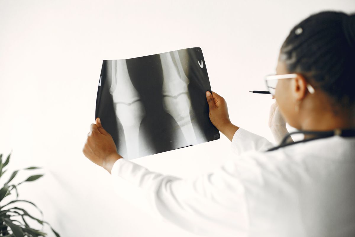 Doctor examining an X-ray film